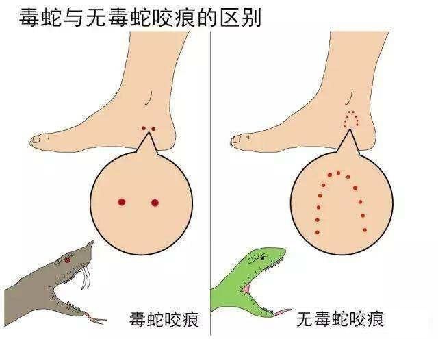 蛇毒丸 印度毒蛇咬伤的原因及紧急处理方式让人叹为观止论文