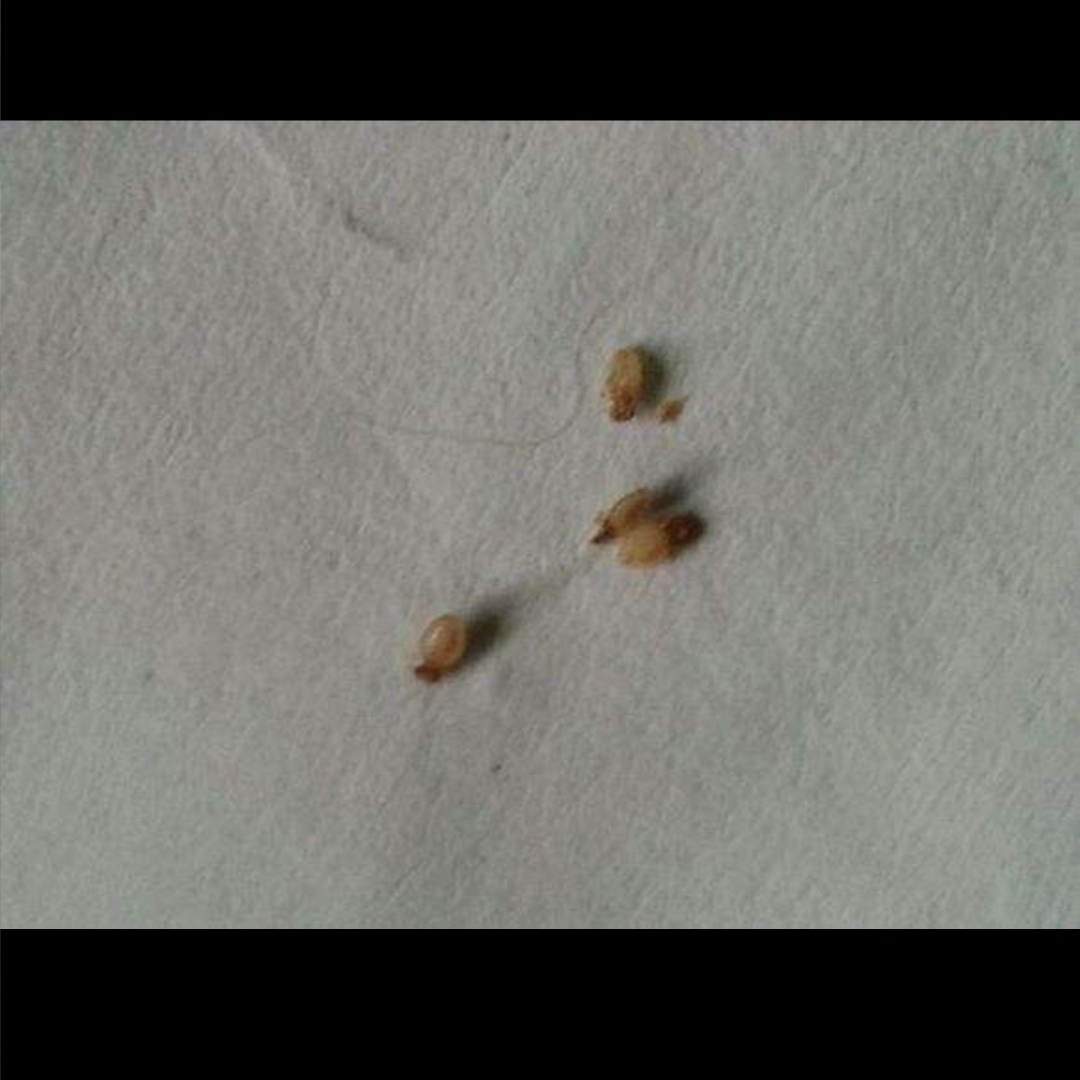 狗弓形体病_现世信物狗和弓_虚弓落病雁