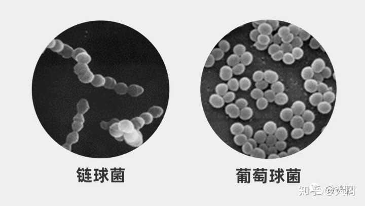 狗 病_狗为何会得疯狗病_病狗星期狗