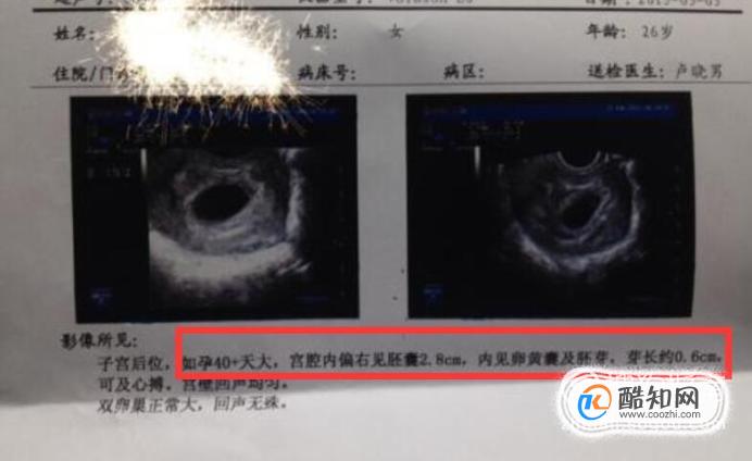 怀孕的时候能养狗吗_狗怀孕能喂鸡架吗_狗和小孩能一起养吗